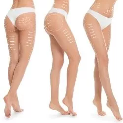 Flacidez da pele: tratamento, causas e prevenção