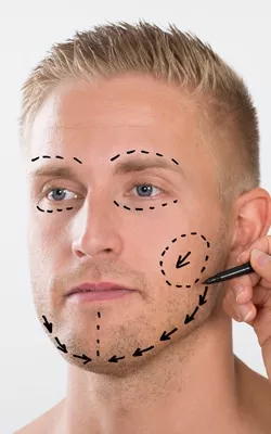 Cresce o número de cirurgia plástica em homens