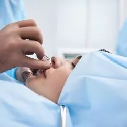 Rinoplastia fechada e aberta: qual a diferença?