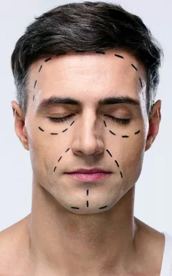 Desvio de Septo – Deformidade Na Estrutura Do Septo Nasal