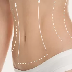 Abdominoplastia