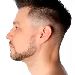 Rinoplastia Estruturada