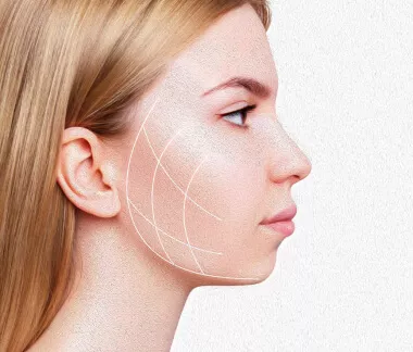 Mentoplastia: Cirurgia no queixo