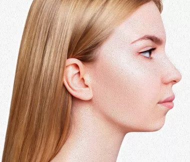 Mentoplastia: Cirurgia no queixo