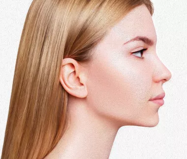 Mentoplastia: Cirurgia no queixo