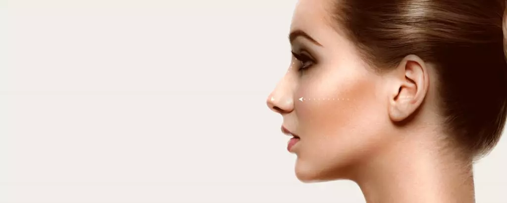 Rinoplastia: como funciona?